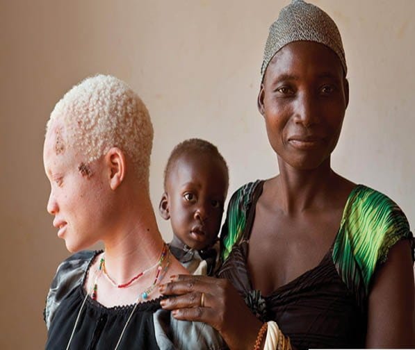 अंधविश्वास से भरे हैं ये 11 देश बच्चों से लेकर डेड बॉडी तक खा जाते हैं ये लोग!