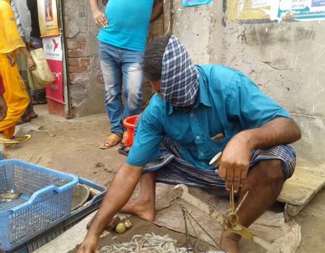 बाघ ने नोंच लिया था इस शख्स का चेहरा, 20 साल तक रखा छुपाकर दुनिया से!