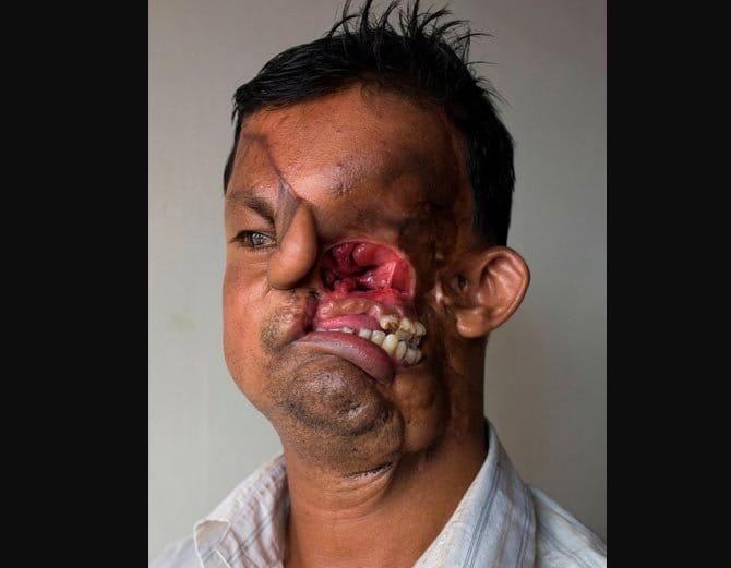 बाघ ने नोंच लिया था इस शख्स का चेहरा, 20 साल तक रखा छुपाकर दुनिया से!